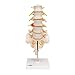 3B Scientific A76/5 Lumbar Spinal Column with Dorso-Lateral Prolapsed Intervertebral Disc, 13.4