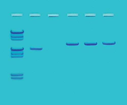 Edvotek 124-C DNA-Based Screening for Smallpox