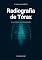 Livro Radiografia de Tórax MEDNEIF