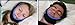 My Snoring Solution Anti Snoring Chin Strap Stop Snoring Jaw Strap Best Night Sleep (Md)
