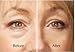 Biotech, Dermasilk 5 Min Face Lift Immediately Lifts, Tightens and Firms Aged Skin - Anti Aging Skin Cream - Last up to 8 Hours Significantly Reduces the Appearance of Fine Lines, Wrinkles and Sagging Skin 1 oz