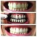 Teeth Whitening Activated Charcoal Toothpaste Kit - All Natural Organic Coconut Charcoal Powder With 2 Toothbrushes. Safer Alternative to Tooth Whitener Strips or Gel.