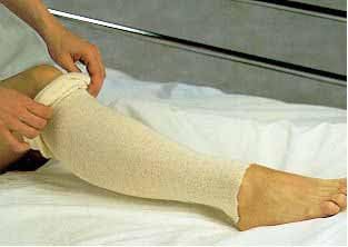 Stockinette, AlbaHealth Tubular 3 Inch X 25 Yard Cotton NonSterile Stockinette for Men and Women (1 Pack/PR)