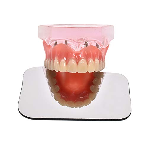 image for Wecando 5Pcs Dental Reflector Mirror Two-sided Photographic Oral Mirro