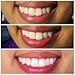 Activated Charcoal Toothpaste Teeth Whitening Powder - ORGANIC LABS®