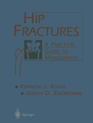 Read Hip Fractures: A Practical Guide to Management [E.P.U.B]