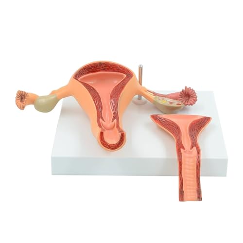 Educational Model Uterine Lesion Model Female Internal and External Organs Anatomical Model PVC Human Anatomy Science Models