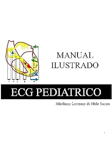 Manual Ilustrado ECG Pediátrico: Sthefanny Lourrany