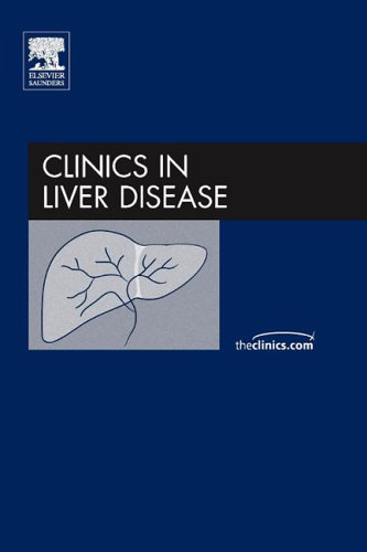 Alcoholic Liver Disease, An Issue of Clinics in Liver Disease, 1e (The Clinics: Internal Medicine) Alcoholic Liver Disease, An Issue of Clinics in Liver Disease, 1e (The Clinics: Internal Medicine)