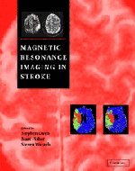 Magnetic Resonance Imaging in Stroke by