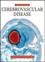 PRINCIPLES OF CEREBROVASCULAR DISORDERS