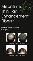 Meantime Thin Hair Enhancement Fibers (Medium Brown) - Pliable Hair Enhancement product for Receding Hairline & Overall Thinning - Thickens & Cover Maximum Thin Areas