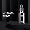 IMIM-Acne-Treatments-Serum-Double-Strength-Spot-Blemishes-Blackheads-Removal-Treatment-Suitable-for-Prone-to-Acne-Face-Serum-for-All-Skin-Types IMIM Acne Treatments Serum Double Strength Spot Blemishes Blackheads Removal Treatment Suitable for Prone to Acne Face…
