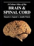 Color Atlas of the Brain and Spinal Cord, England, Marjorie A., 0801662885