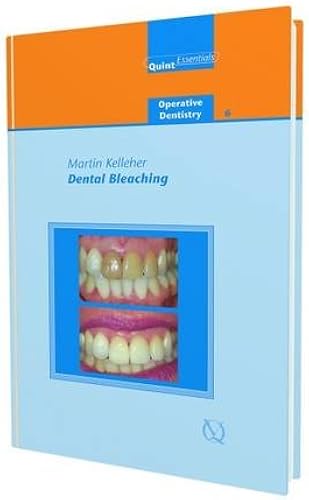 Download Dental Bleaching PDF