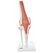 3B Scientific A82 Functional Knee Joint - 3B Smart Anatomy
