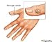 2 Hongosan Best Anti-fungus Fungal Killer Fast Cure the Best Product 4 Cure Nail Hongosan Para Combatir Los Hongos En Las Uñas Mejor Que Zanaquick