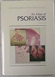 An Atlas of Psoriasis, Fry, L., 1850704104