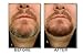 Blackbeard for Men Formula X – Instant Hypoallergenic Beard Dye, Temporary Beard Filler, Mustache, Eyebrow & Sideburn Tint – Brown/Auburn, 3 Pack