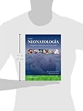 Image de Avery. Neonatología (Spanish Edition)