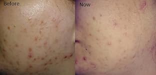 Review Image by FishyBrittyKitty