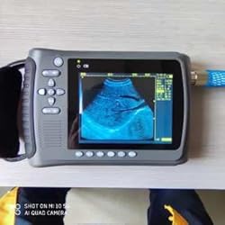 2023 Convex Newest Ultrasound Machine for Pregnancy