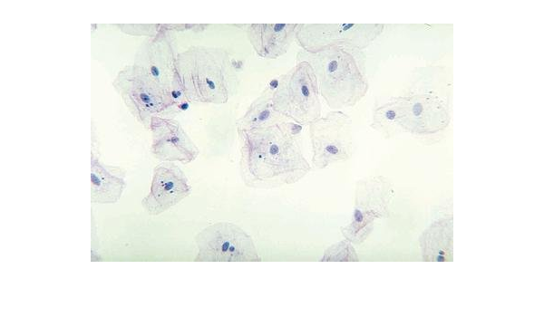 470176 954 Squamous Epithelium Human Cheek Cells Smear Hematoxylin Eosin Stain Squamous Epithelium Human Cheek Cells Each Amazon Com Industrial Scientific
