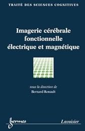 Imagerie cérébrale fonctionnelle électrique et magnétique