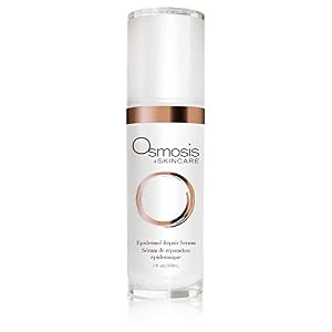 Osmosis Skincare Epidermal Repair Serum, Rosacea and Dark Spot Corrector for Face, Rescue