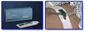Special Pack of 5 Foley Catheter Holder Dale - Dale Medical 316