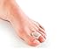 Dr Rogo Toe Spacers For Bunions Treatment Aid, Crooked Toes Alignment & Big Toe Joint Pain Relief