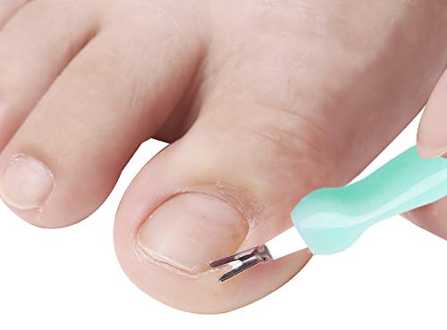 Pedicure Kit Set 6 in 1,Moricoxs Colossal Foot Rasp Foot File And Callus Remover For Feet, Stainless Steel Foot Care Tools, Foot Rasp, Feet Dead Skin Remover,Pedicure Kit For Men Women Gift