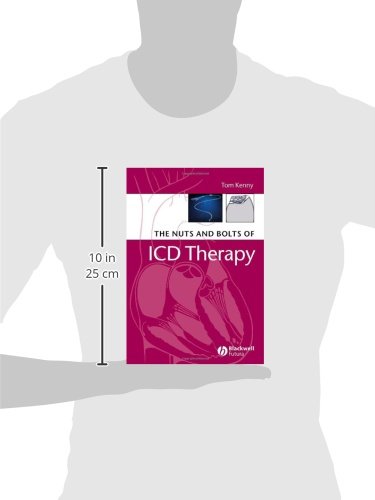 The Nuts and Bolts of ICD Therapy - Thumbnail 2