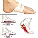 FootSmart Men's / Women's Arch Brace