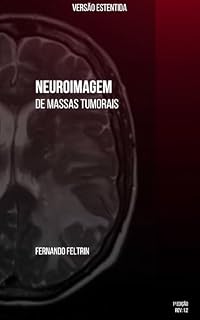 Livro Neuroimagem de Massas Tumorais: Versão Estendida