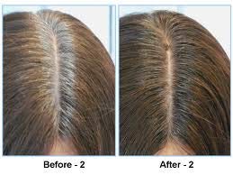 Godefroy Hair Color Kit for Spot Coloring, Covers Up Gray Hairs, Medium Brown, 4-Application Kit - Thumbnail 2