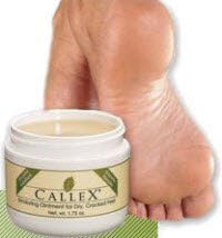 Callex Callus Foot and Heel Ointment - Smoothes and Softens Cracked Feet