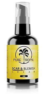 Pure Tropix Acne Scar Treatment for Face & Blemish Removal Cream | Stretch Mark Cream & Face Body Moisturizer | Anti Aging Skin Repair Cream | Anti Wrinkle Cream & Acne Blemish Treatment | 2 oz (59 ml