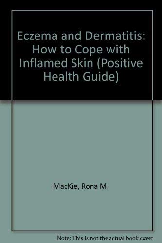 Eczema And Dermatitis How To Cope With Inflamed Skin Positive Health Guides Mackie Rona 9780356144566 Amazon Com Books