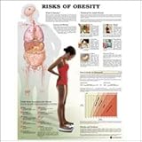 Risks of Obesity Anatomical Chart