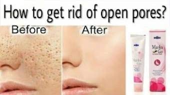 marks go homeopathic cream