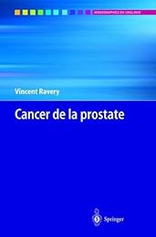 Cancer de la prostate