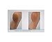 Emjoi Micro-Pedi Black Super-Coarse Refill Rollers/Set of 4