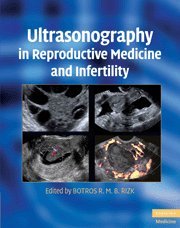 ULTRASONOGRAPHY IN REPRODUCTIVE MEDICINE AND INFERTILITY