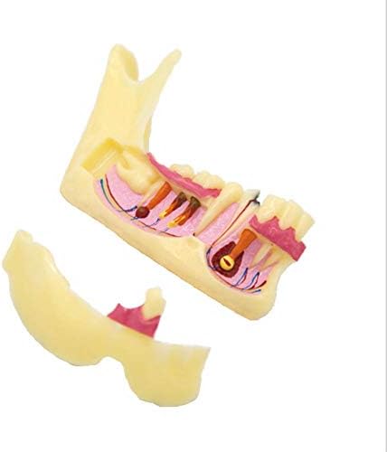 SHUAI Dental Dentist Implanted Model Periodontal Disease Dental Teaching Research Typodont Model Demonstration Tooth Model