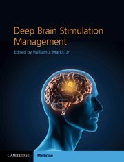 DEEP BRAIN STIMULATION MANAGEMENT