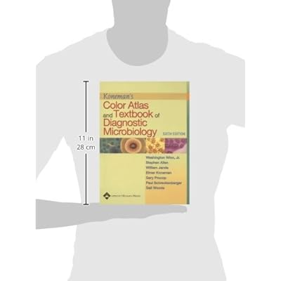 Koneman's Color Atlas and Textbook of Diagnostic Microbiology (Color Atlas & Textbook of Diagnostic Microbiology) eBook PDF Download Koneman's Color Atlas and Textbook of Diagnostic Microbiology (Color Atlas & Textbook of Diagnostic Microbiology) PDF