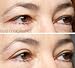 The New Eye Magic Instant Eye Lift (New Larger Shape)