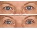 EasyLift The Original 60 Second Eye Lift | As Seen On TV | Lab Tested For Save Everyday Use | Made In the USA