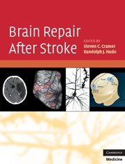 BRAIN REPAIR AFTER STROKE